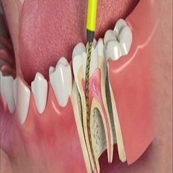 Image for Smile Dental Lakeside with ID of: 1338496