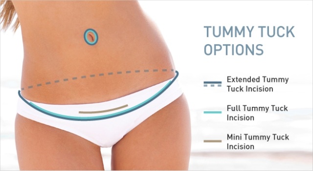 Image for Midwest Plastic Surgery - Dr. George Kouris, MD with ID of: 1340980