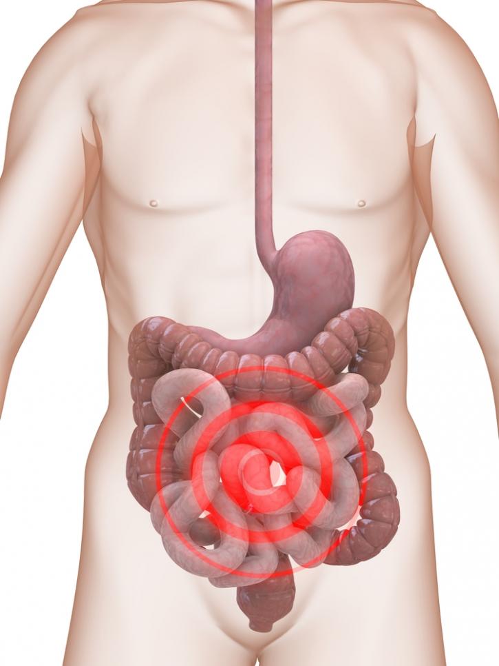 Image for irritable Bowel syndrome diet with ID of: 1342585