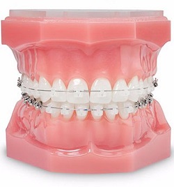 Image for Damon Orthodontics with ID of: 1357429