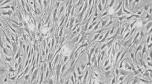 Image for CAL-51 with ID of: 1365011
