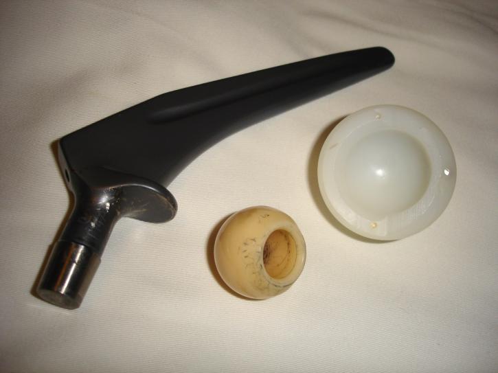 Image for Hip Replacement: Total Hip Replacement Procedure & Implant Risks with ID of: 1365212