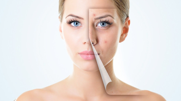 Image for Your Answer To Removing Stretch Marks with ID of: 1389300
