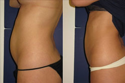 Image for Beverly Hills Aesthetics with ID of: 1403664