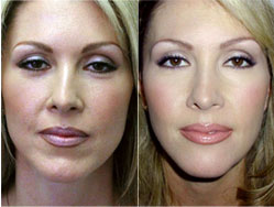Image for Beverly Hills Aesthetics with ID of: 1403665