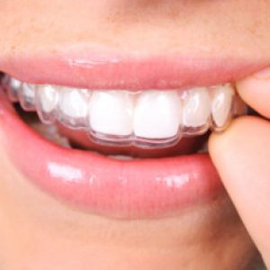 Image for Dr. Rodney Raanan, DDS MMSc. with ID of: 1418194