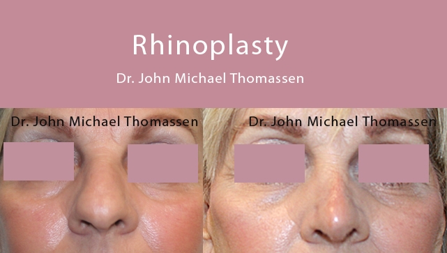 Image for John Michael Thomassen, MD with ID of: 1418626