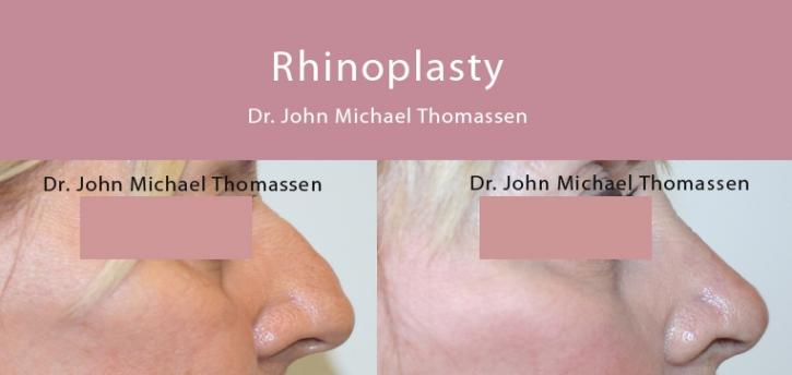 Image for John Michael Thomassen, MD with ID of: 1418627