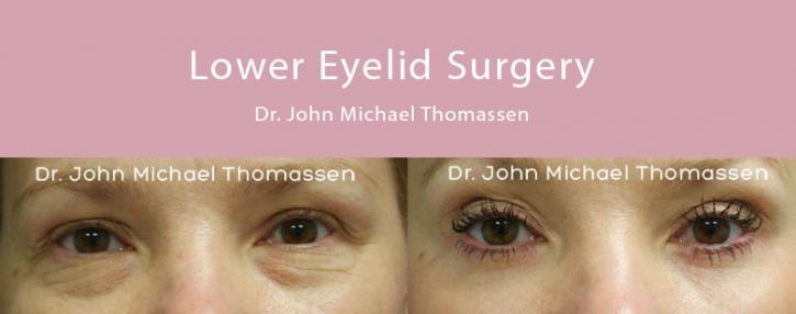 Image for John Michael Thomassen, MD with ID of: 1418628