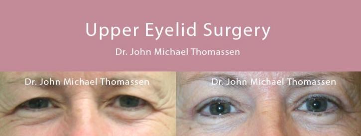 Image for John Michael Thomassen, MD with ID of: 1418629