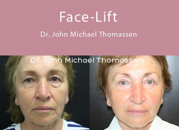Image for John Michael Thomassen, MD with ID of: 1418630