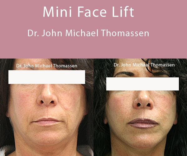 Image for John Michael Thomassen, MD with ID of: 1418631
