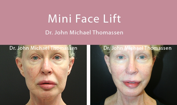 Image for John Michael Thomassen, MD with ID of: 1418632