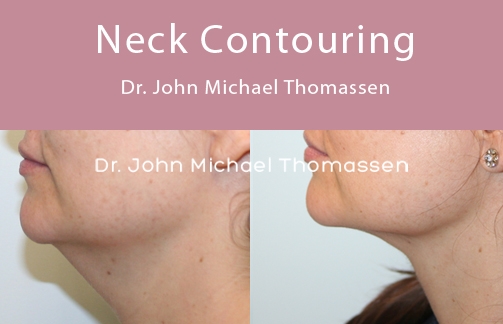 Image for John Michael Thomassen, MD with ID of: 1418633