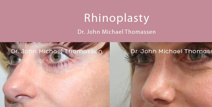 Image for John Michael Thomassen, MD with ID of: 1418634