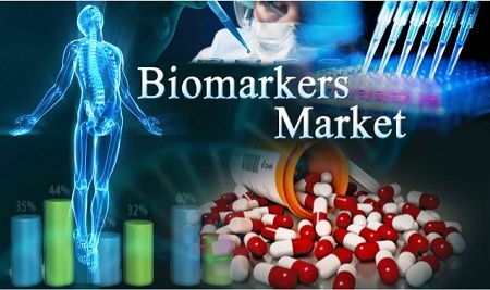 Image for Biomarker Technologies Market: 2016 Industry Analysis, Segment & Forecast up to 2020 with ID of: 1419969