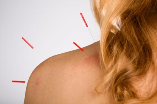Image for City Acupuncture with ID of: 1422613