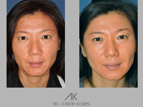 Image for Dr. Aaron Kosins with ID of: 1426758