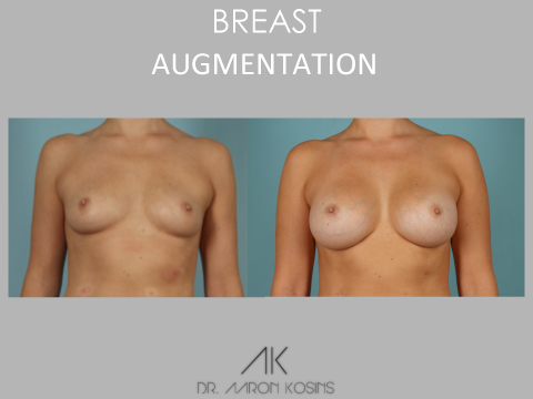 Image for Dr. Aaron Kosins with ID of: 1426759