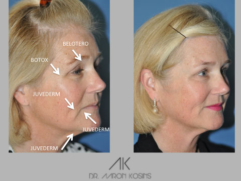 Image for Dr. Aaron Kosins with ID of: 1426760
