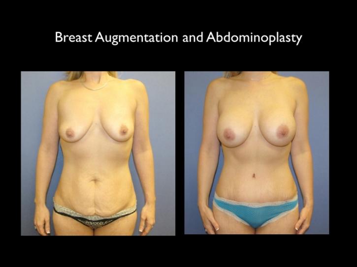 Image for Black Hills Plastic Surgery with ID of: 1444682