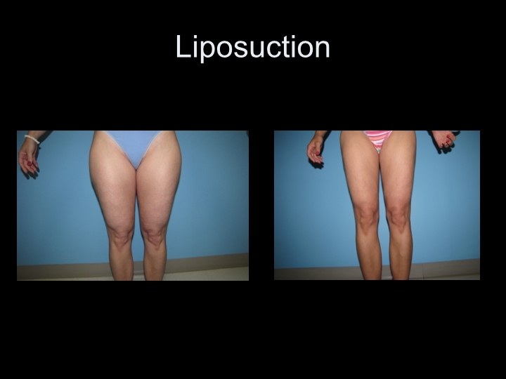 Image for Black Hills Plastic Surgery with ID of: 1444683