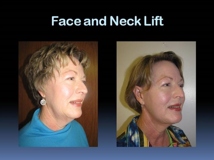 Image for Black Hills Plastic Surgery with ID of: 1444684
