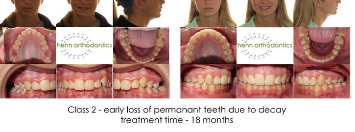 Image for Henn Orthodontics with ID of: 1444764