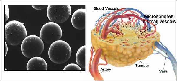 Image for Vascular & Interventional Radiology with ID of: 1449643