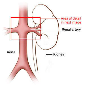 Image for Vascular & Interventional Radiology with ID of: 1449644