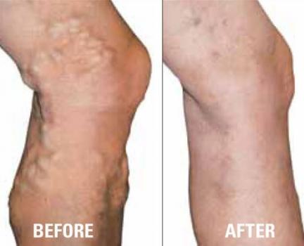 Image for Northeast Vein & Laser Center with ID of: 1455124