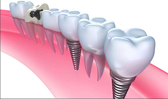 Image for Prima Dental with ID of: 1460726