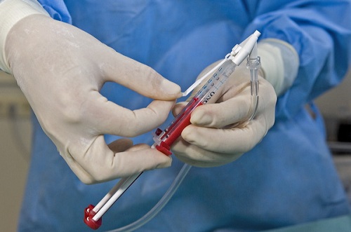 Image for Fibrin Glue Market: By End-User, Application, Regional Segment Analysis, 2014 - 2020 with ID of: 1463297