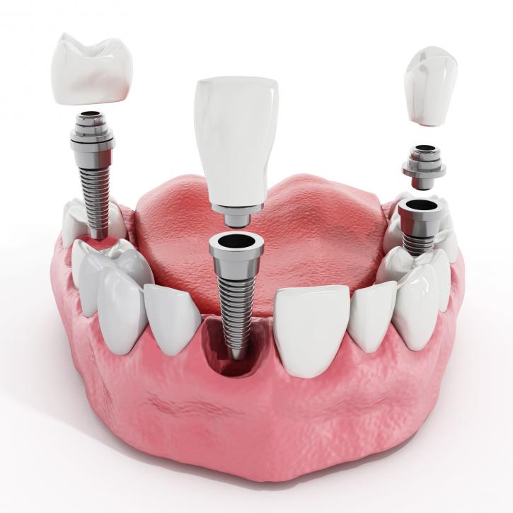 Image for Burnaby Square Dental with ID of: 1466803