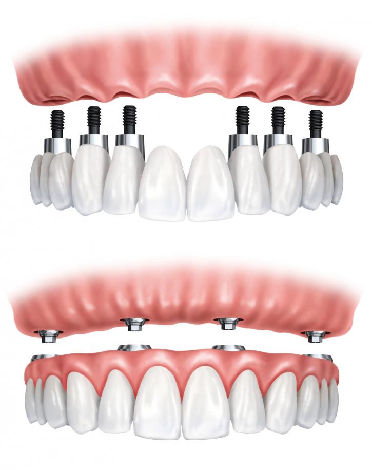 Image for Burnaby Square Dental with ID of: 1466806