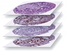 Image for Global Digital Pathology Analytics Market 2016 Product Types,Sales,Price,Share and Growth 2021 with ID of: 1469010