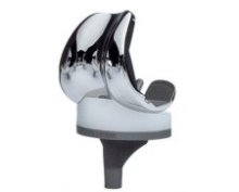 Image for Global Knee Replacement Devices Market 2016 Product Types,Sales,Price,Share and Growth 2021 with ID of: 1470218