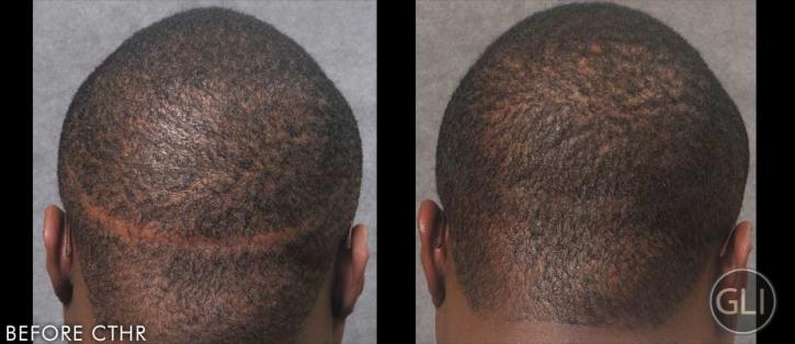 Image for Samson Hair Restoration with ID of: 1477183