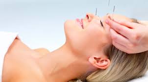 Image for Perfect Union Mind & Body Acupuncture with ID of: 1488185