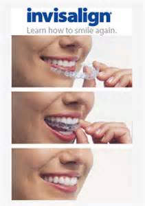 Image for Exeter Orthodontics with ID of: 1504890