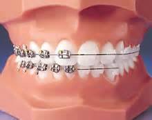 Image for Exeter Orthodontics with ID of: 1504892