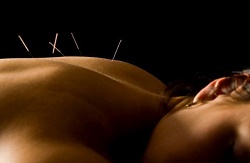 Image for Sheila Acupuncture Naples with ID of: 1515591