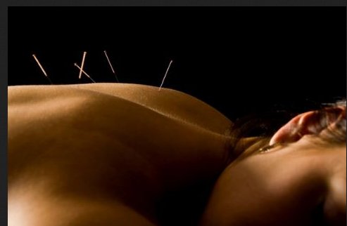 Image for Sheila Acupuncture Naples with ID of: 1525696
