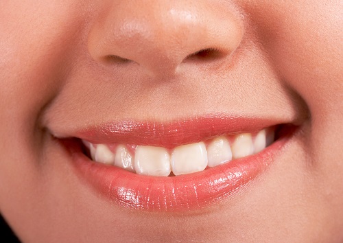 Image for All Brite Dental with ID of: 1540820