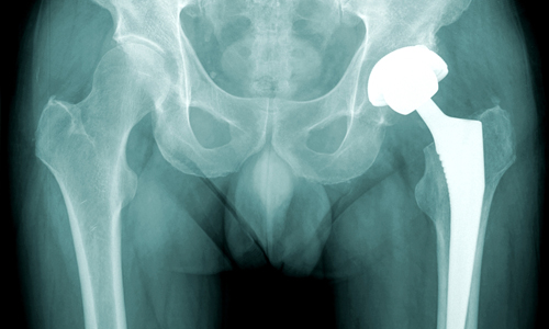 Image for Body Electric Rejuvenation Center with ID of: 1559167