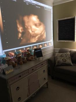 Image for Miracle In Progress Ultrasound with ID of: 1563251