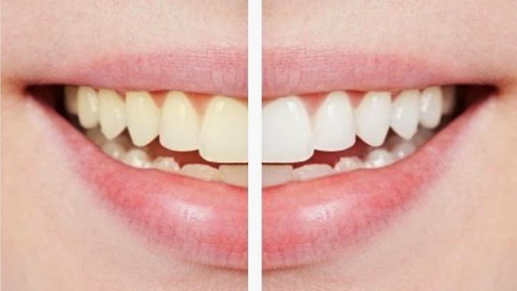 Image for Masterpiece Smiles with ID of: 1564420