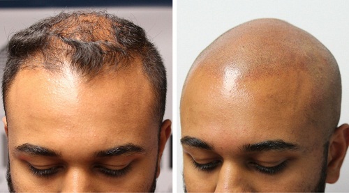 Image for Hairline Ink with ID of: 1569083