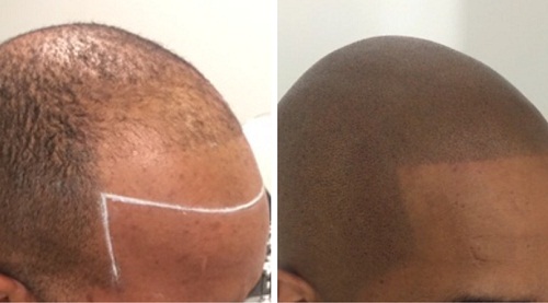 Image for Hairline Ink with ID of: 1569087