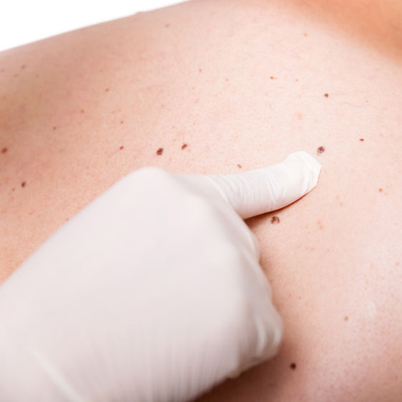 Image for Eastside Dermatology with ID of: 1581428